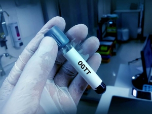 Exploring the Oral Glucose Tolerance Test (OGTT): A Comprehensive Guide 