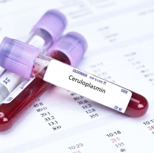 Ceruloplasmin Testing: Exploring Low and High Levels and Ways to Improve Them