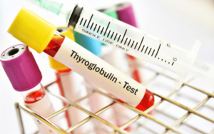 Everything You Need To Know About Thyroglobulin Test